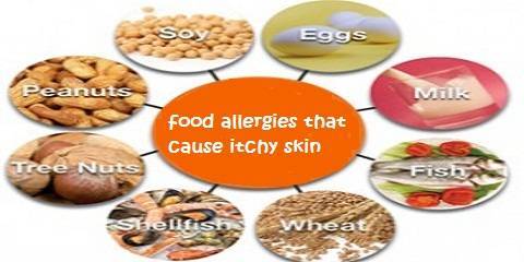 Common Food Allergies That Cause Itchy Skin