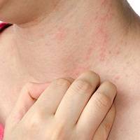 What Allergies Cause Itchy Skin