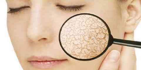 home remedies for dry skin on face