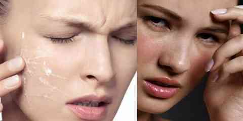 what causes dry itchy skin on face