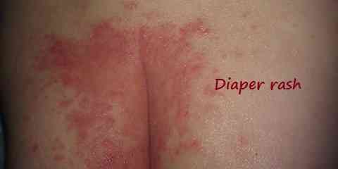 different skin rashes