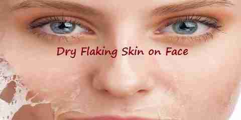 Dry Flaking Skin on Face