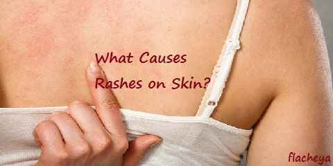 What Causes Rashes on Skin