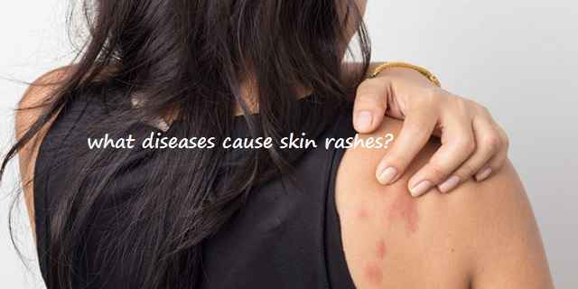 What Diseases Cause Skin Rashes